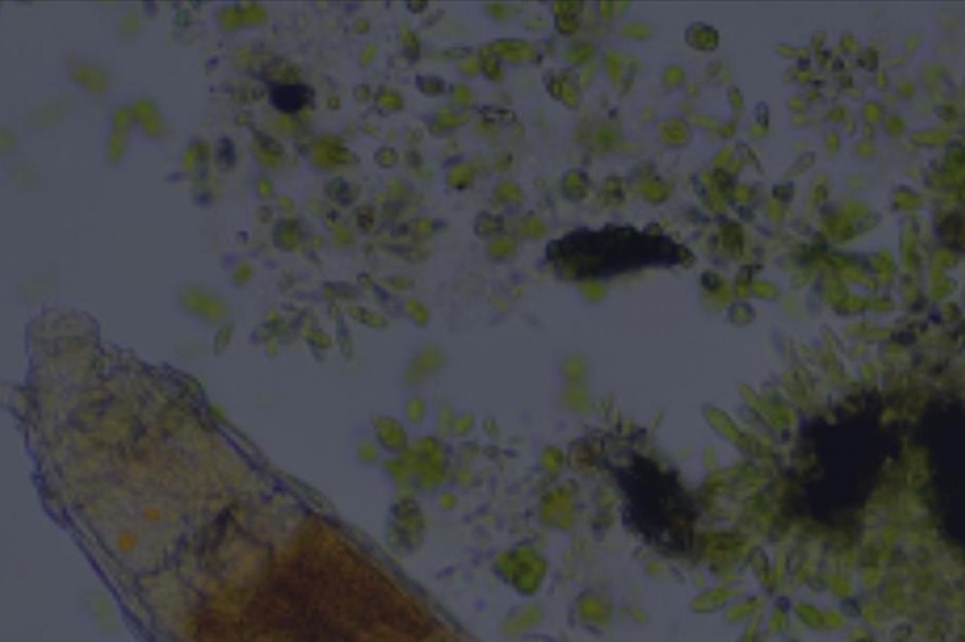 24 Bin Yıl Hayatta Kalmayı Başarabilen Mikroskobik