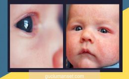 Bebeklerde göz kızarıklığı ve kaşıntı nedenleri! Bebeğinizin gözleri sulanıyorsa…